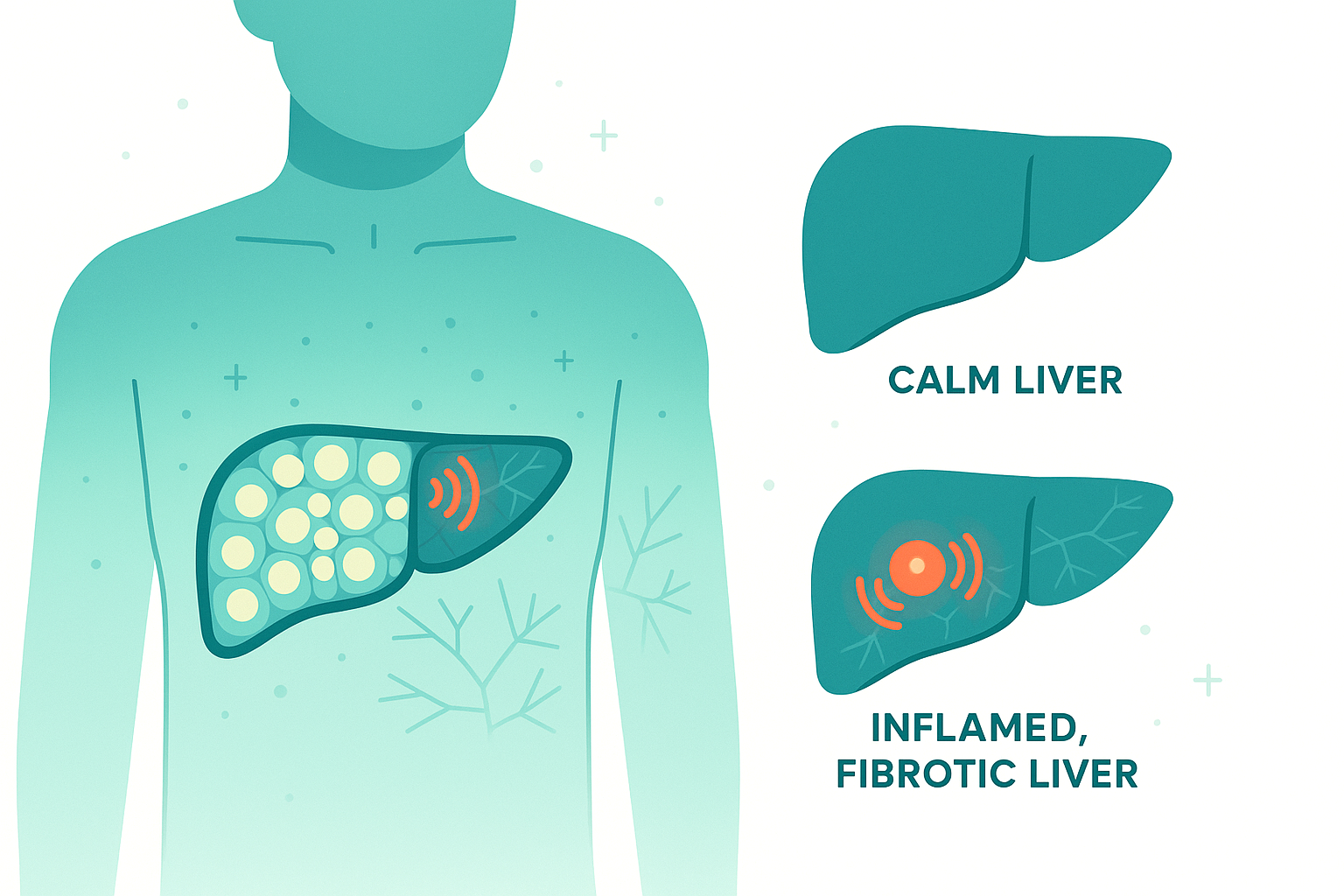 Metabolic issues – insulin resistance, diabetes, obesity, high triglycerides (this is MASLD, formerly called NAFLD)